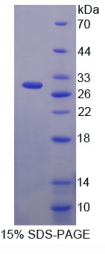 62kDa核孔蛋白(NUP62)重组蛋白