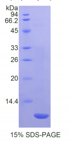 Ⅱ型胶原α1(COL2α1)重组蛋白