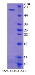 猫眼综合征染色体区候选基因1(CECR1)重组蛋白