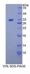 Ⅰ型胶原α1(COL1α1)重组蛋白