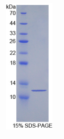 70kDa热休克蛋白8(HSPA8)重组蛋白