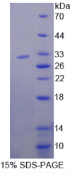 85kDa核孔蛋白(NUP85)重组蛋白