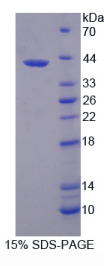 3-羟基丁酸脱氢酶1(BDH1)重组蛋白