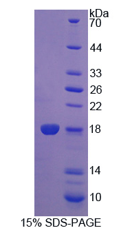 细胞程序性死亡蛋白5(PDCD5)重组蛋白