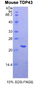 43kDa Tar DNA结合蛋白(TDP43)重组蛋白