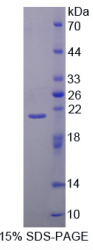 40kDa热休克蛋白2(HSPF2)重组蛋白