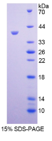 滋养层特异性糖蛋白(TPBG)重组蛋白