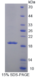 粘蛋白5B(MUC5B)重组蛋白