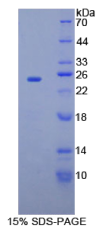 侧支发芽因子同源物2(SPRY2)重组蛋白