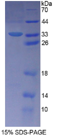 Schlafen家族成员5(SLFN5)重组蛋白