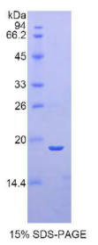 白介素1家族成员9(IL1F9)重组蛋白