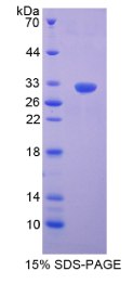S抗原(SAG)重组蛋白