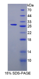 表面活性物质关联蛋白A2(SPA2)重组蛋白