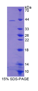 防御素α1B(DEFα1B)重组蛋白