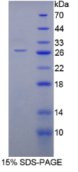 SHC-转化蛋白2(SHC2)重组蛋白