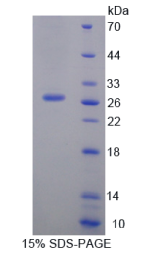 蛋白二硫化物异构酶A2(PDIA2)重组蛋白