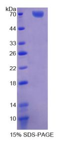 转录因子Dp1(TFDP1)重组蛋白