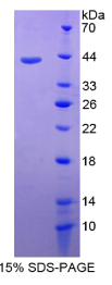 CD3d分子(CD3d)重组蛋白