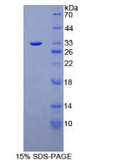 蛋白激酶N1(PKN1)重组蛋白