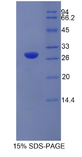 弹性蛋白酶3B(ELA3B)重组蛋白