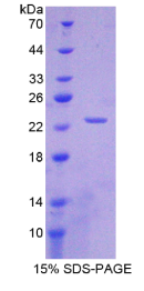 白介素1α(IL1α)重组蛋白