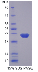 Gremlin 2蛋白(GREM2)重组蛋白