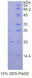 CD247分子(CD247)重组蛋白