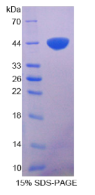 S100钙结合蛋白A11(S100A11)重组蛋白