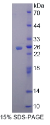 Metaxin 1蛋白(MTX1)重组蛋白