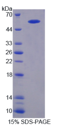 淀粉样蛋白β前体蛋白结合蛋白B1相互作用蛋白(APBB1IP)重组蛋白
