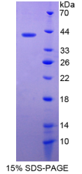 半胱氨酸蛋白酶抑制剂3(CST3)重组蛋白