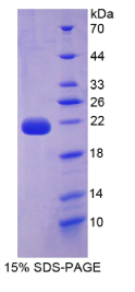 白介素22(IL22)重组蛋白