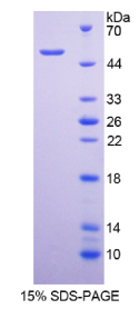 白介素28A(IL28A)重组蛋白