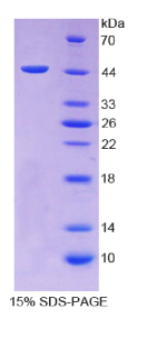 转化生长因子β1(TGFβ1)重组蛋白