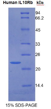 白介素10受体β(IL10Rβ)重组蛋白