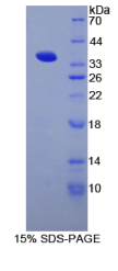 CD1d分子(CD1d)重组蛋白