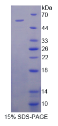 雌激素受体α(ERα)重组蛋白