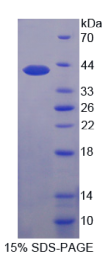 防御素β126(DEFβ126)重组蛋白