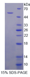 Ⅴ型胶原α2(COL5α2)重组蛋白