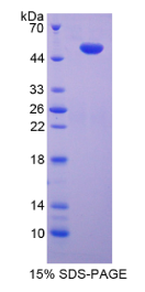 Toll样受体10(TLR10)重组蛋白