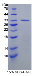 V-Erb B2红白血病病毒癌基因同源物3(ErbB3)重组蛋白