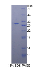 蛋白激酶D2(PKD2)重组蛋白