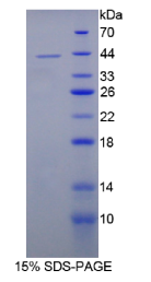 白介素12B(IL12B)重组蛋白