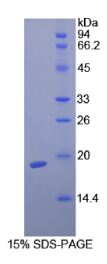 转化生长因子β1(TGFβ1)重组蛋白