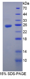 白介素35(IL35)重组蛋白