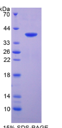 表面活性物质关联蛋白A2(SPA2)重组蛋白