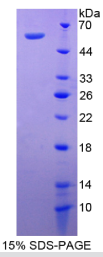 Notch同源物3(NOTCH3)重组蛋白