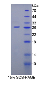 白介素12A(IL12A)重组蛋白