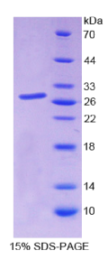 Sp140核体蛋白(SP140)重组蛋白