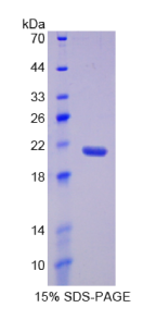 补体成分5(C5)重组蛋白